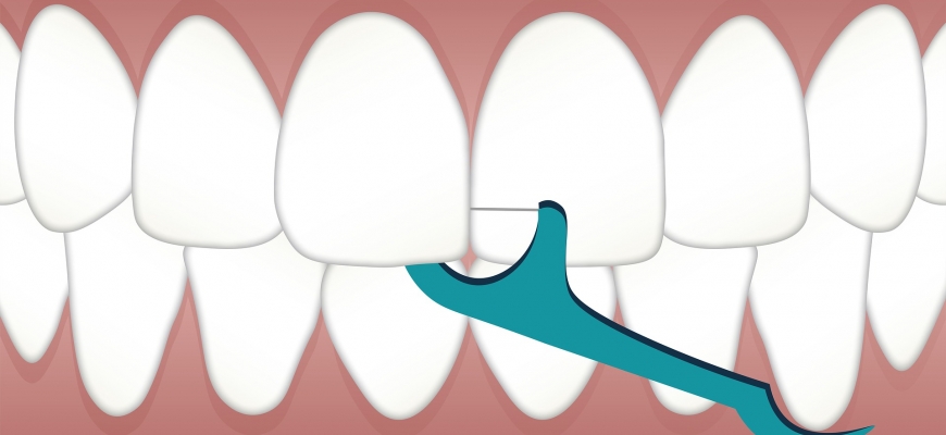 Fio dental: uso diário